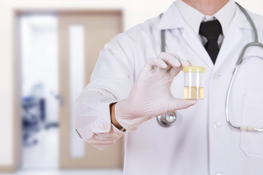 Will I Fail A Drug Test Because of CBD?