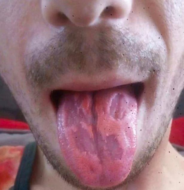 Here Is What Toxic Energy Drinks Can Do To Your Tongue - Kill Cliff